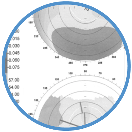 Topografia Corneale Orbscan